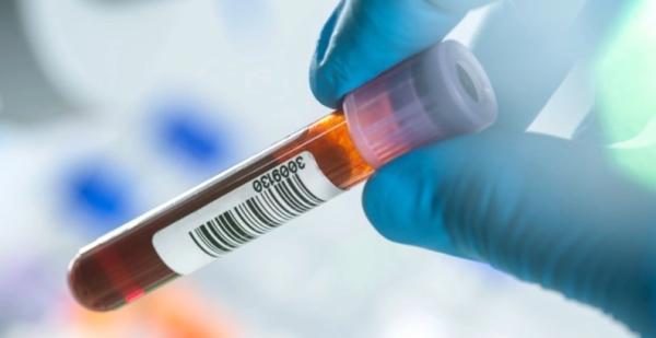 این آزمایش خون منفرد می تواند انواع مختلف سرطان را زودهنگام تشخیص دهد: تشخیص سرطان با DNA رها شده در خون