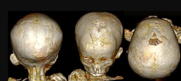 تصاویر ، کشف دلیل مرگ بچه ها در مصر باستان ، رازهایی که سی تی اسکن مومیایی های بچه ها فاش کرد