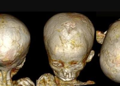 تصاویر ، کشف دلیل مرگ بچه ها در مصر باستان ، رازهایی که سی تی اسکن مومیایی های بچه ها فاش کرد